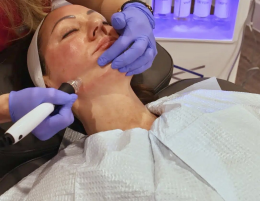 injectable treatment options at RBMC
