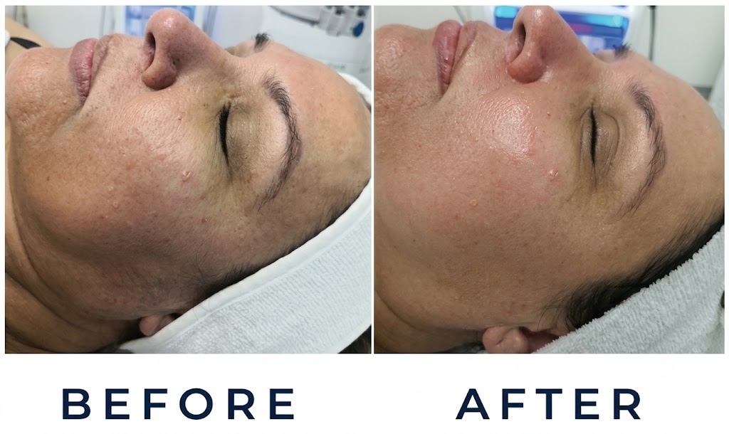 AquaFirmeXS before-and-after image from the RBMC marketing library. Individual results vary.