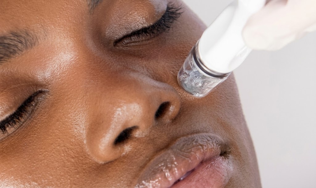 DiamondGlow® treatment image from the original marketing draft. Ross Bridge Medical Center does not currently offer DiamondGlow.